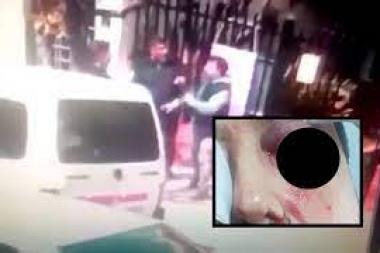 Papis del grupo de whatsapp: se agarraron a piñas en la puerta de la escuela y uno perdió un ojo