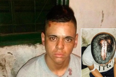 Hasta que no maten a alguien no van a parar: otro pibe molido a palos por patovicas de la noche platense