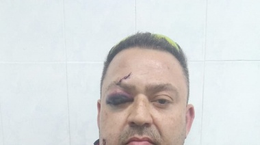 El mejor amigo del hombre: un perro mordió un cartel de Alak,lo vieron unos "muchachos" y molieron a golpes al dueño del perro