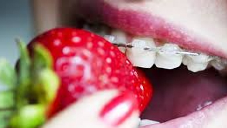 Echan a una empleada de emergencias por burlarse de un accidente sexual con brackets