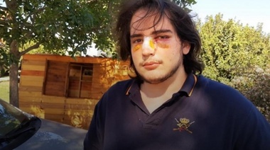 Rugbiers siguen repartiendo valores, ahora desfiguraron a un pibe y el hijo de un ex Puma es uno de los agresores