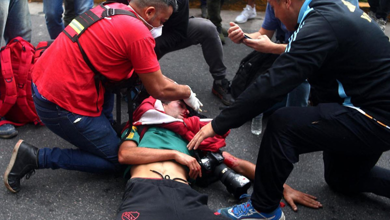Más infame no se consigue: Gendarmería dice que la culpa fue del fotógrafo por poner la cabeza