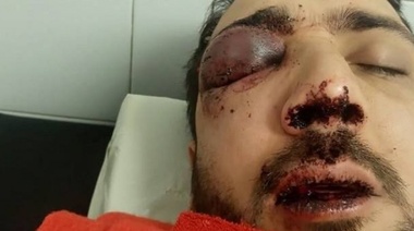 La noche platense, ley de la selva: patovicas de bar Mute desfiguraron a un pibe que podría perder un ojo