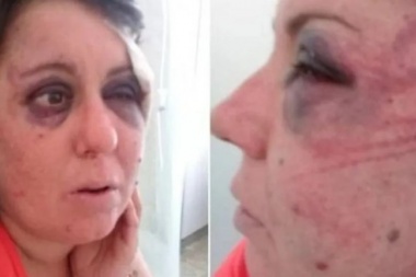 ¿"Quién es la loquita que grita", preguntó?: separan a un comisario de la Costa por brutal paliza a una detenida