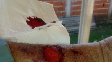 Hay gente mal de la cabeza: lo insultaron y golpearon por andar sin barbijo