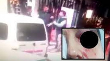 Papis del grupo de whatsapp: se agarraron a piñas en la puerta de la escuela y uno perdió un ojo