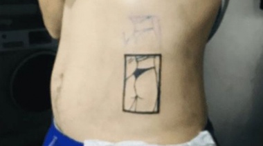 Amor Ciego: se tatuó a un costado de la panza la cola de su novia