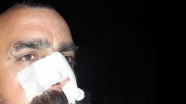 Revisan cámaras de seguridad para dar con el motociclista que agredió a un inspector de Tránsito