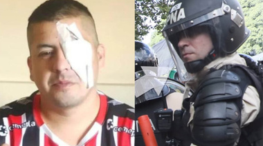 Basura con uniforme: ya se conoce la cara del agente que le sacó un ojo a un manifestante