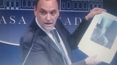 Spagnoulo desenmascaró a Adorni por el asunto de la radiografía del perro y le dijo pelotudo y mentiroso