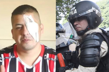 Basura con uniforme: ya se conoce la cara del agente que le sacó un ojo a un manifestante